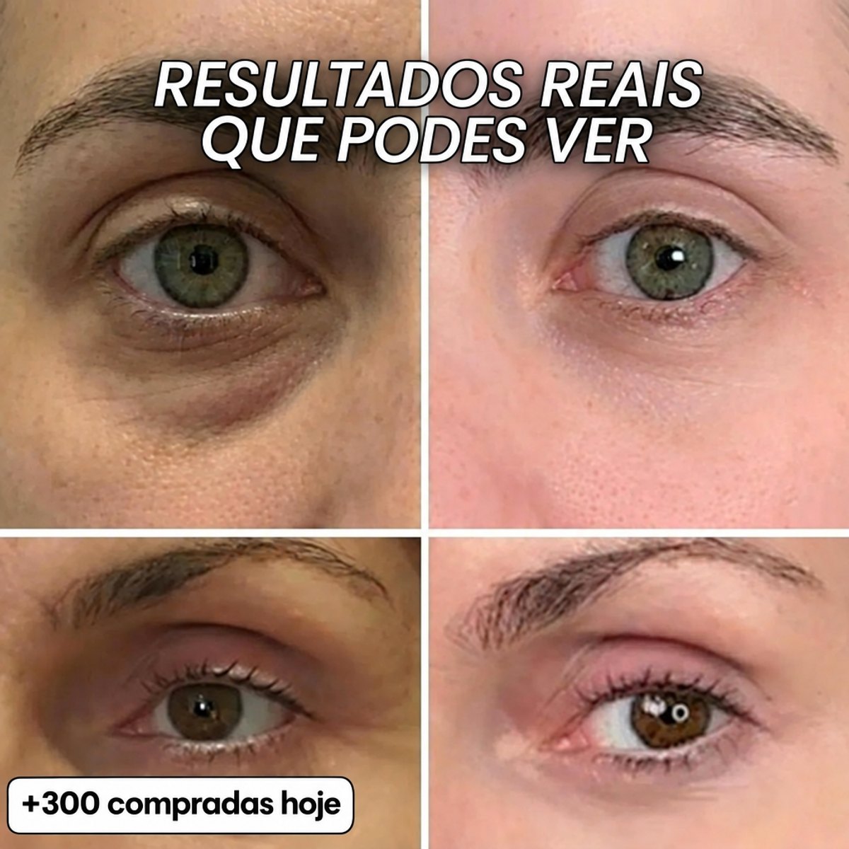 Ilou Skin Stick Preenchedor Bio-Colagénio PDRN