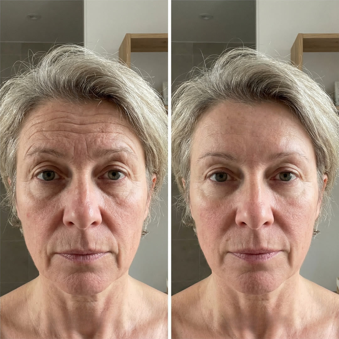 Antes e depois