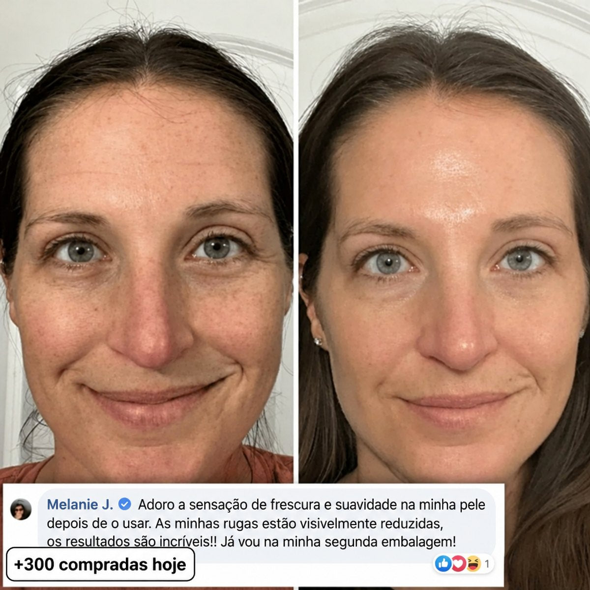 Ilou Skin Stick Preenchedor Bio-Colagénio PDRN