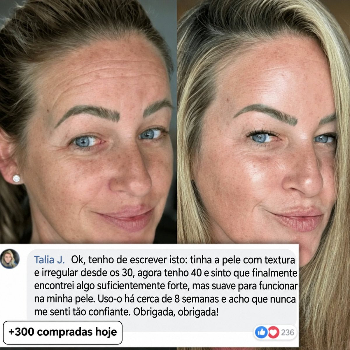 Ilou Skin Stick Preenchedor Bio-Colagénio PDRN